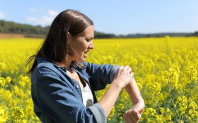 Insektenstiche und Insektengiftallergie