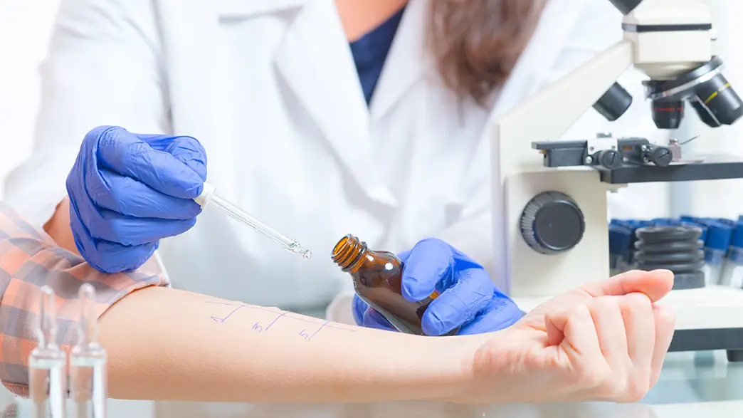 Der Pricktest ist ein Allergietest, der auch eine Hausstaubmilbenallergie nachweisen kann Der Unterarm eines Patienten wird für den Pricktest vorbereitet, indem eine Ärztin per Pipette Tropfen mit Allergenen auf zuvor markierte Hautpartikeln aufbringt
