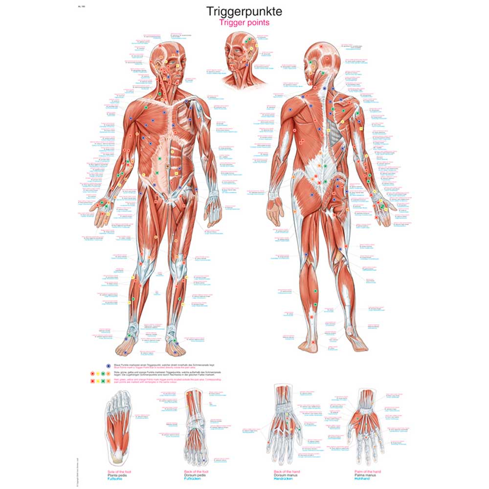 Erler Zimmer anatomische Lehrtafel - "Triggerpunkte", 50x70cm