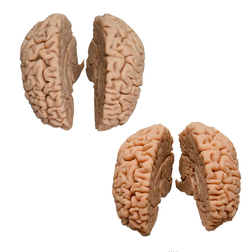 Erler Zimmer Modell - menschliches Gehirn, Naturabguss, 2 Varianten