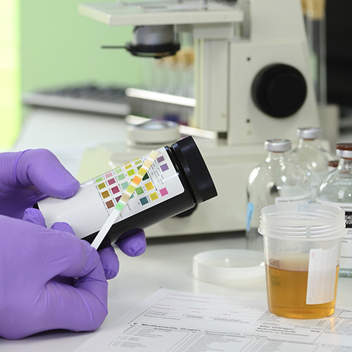 Aufschlussreiche Diagnose mit einem Urinteststreifen von Medicalcorner24® Auswertung eines Urinteststreifens