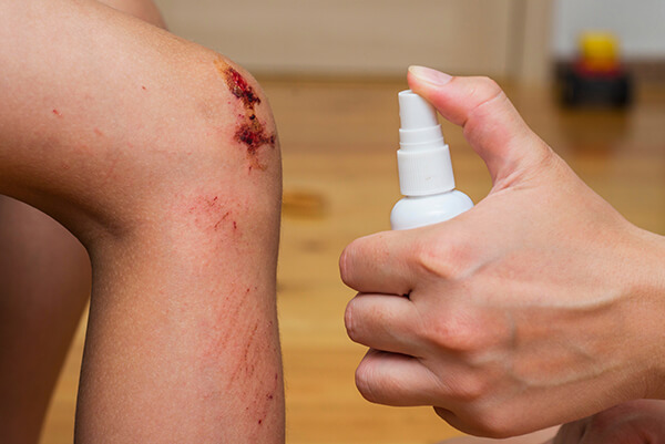 schülke Wunddesinfektion Eine Person sprüht ein verletztes Knie mit schülke Wunddesinfektion ein