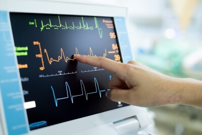 Stationäres EKG-Gerät in Betrieb Finger zeigt auf stationäres EKG-Gerät