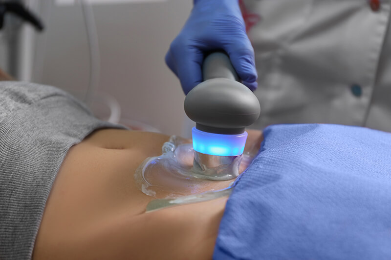 Anwendung des Ultraschallgel Cubitainer 5 l Eine Person nutzt das Ultraschallgel im Cubitainer 5l
