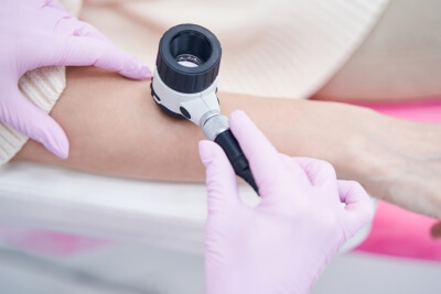 Dermatoskop in Verwendung Ein Arzt nutzt das Dermatoskop zur Hautuntersuchung