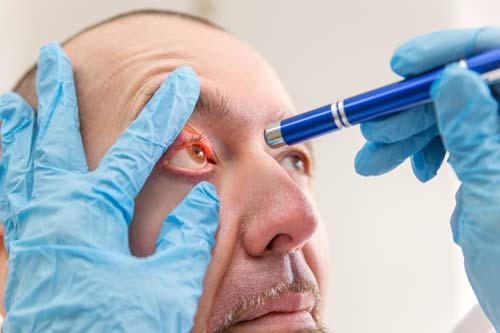 Eine Diagnostikleuchte liegt bequem in der Hand und lässt sich per Druckschalter bedienen Eine Diagnostikleuchte liegt bequem in der Hand und lässt sich per Druckschalter bedienen